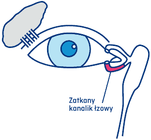 Zatkany dolny kanalik